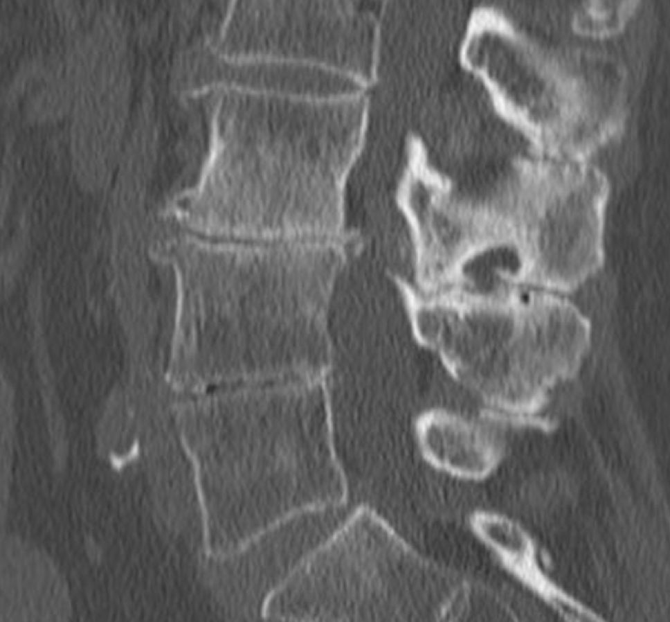 RTG nebo MRI ukázka z diagnostického kurzu