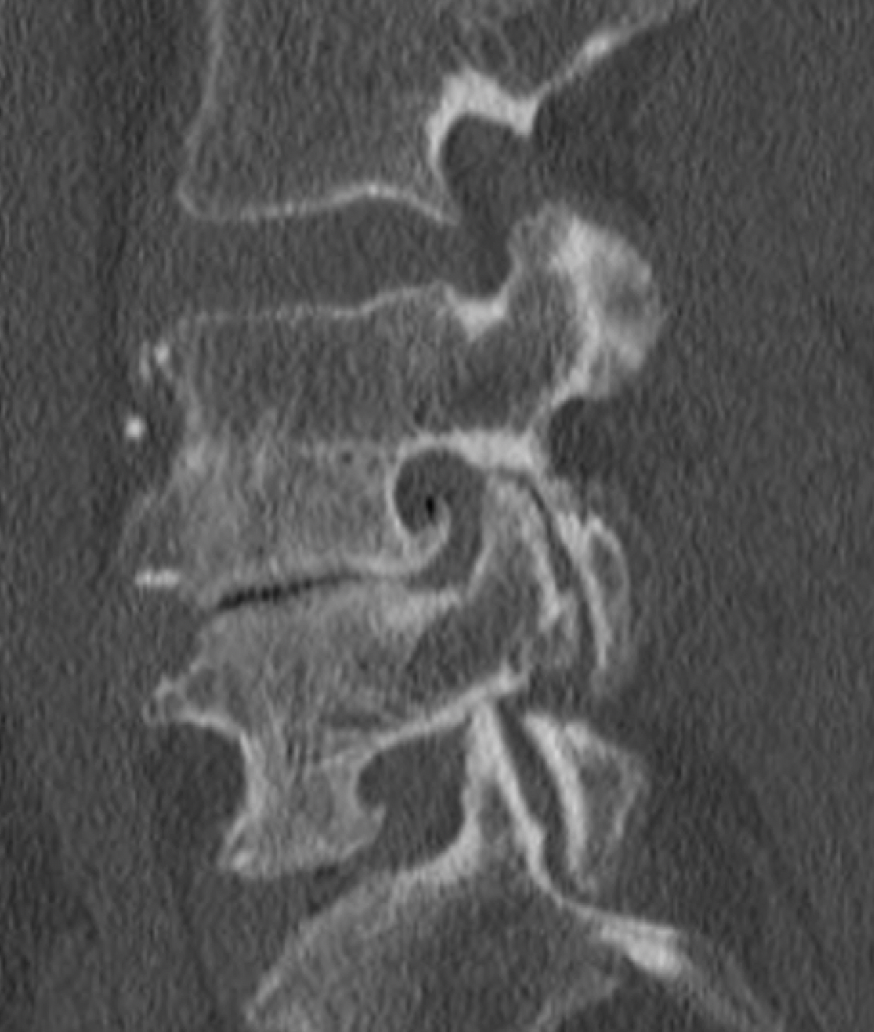 RTG nebo MRI ukázka z diagnostického kurzu