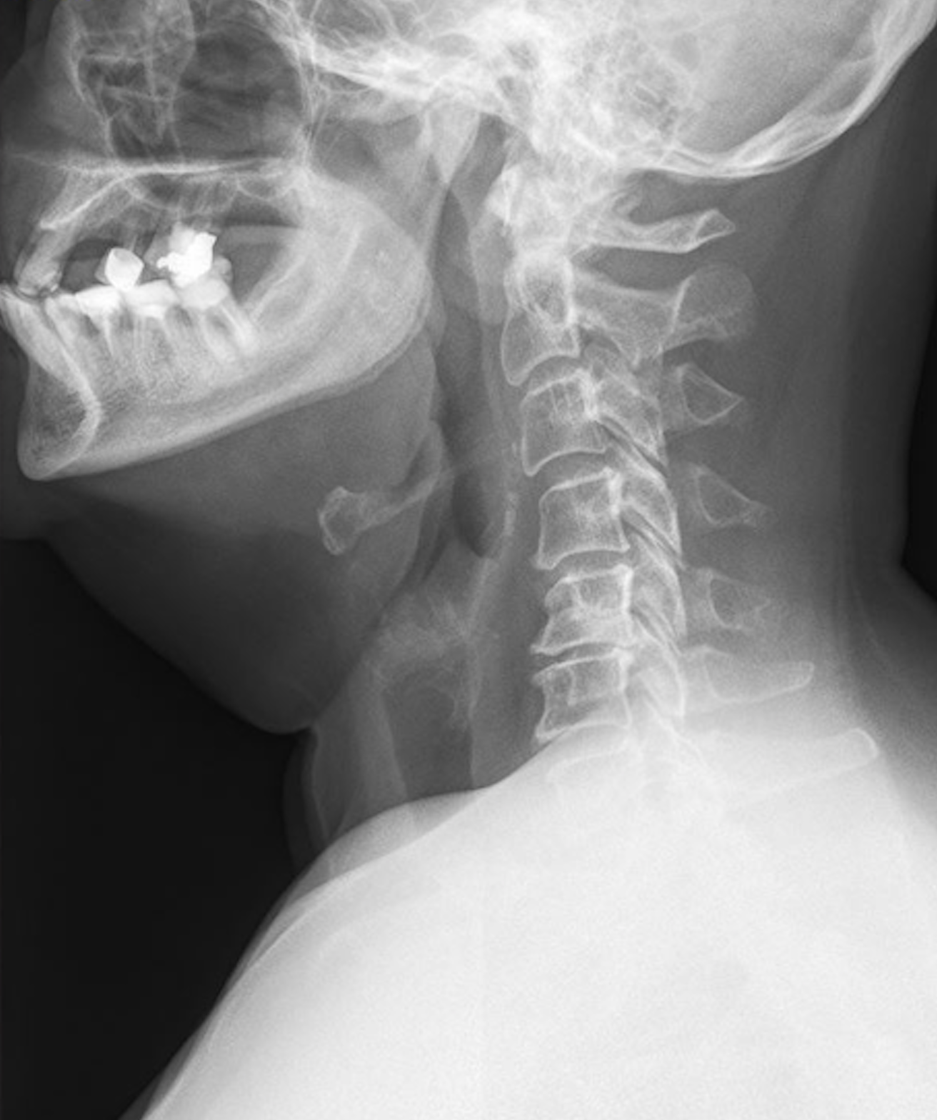 RTG nebo MRI ukázka z diagnostického kurzu