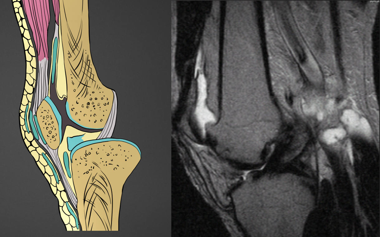 RTG nebo MRI ukázka z diagnostického kurzu