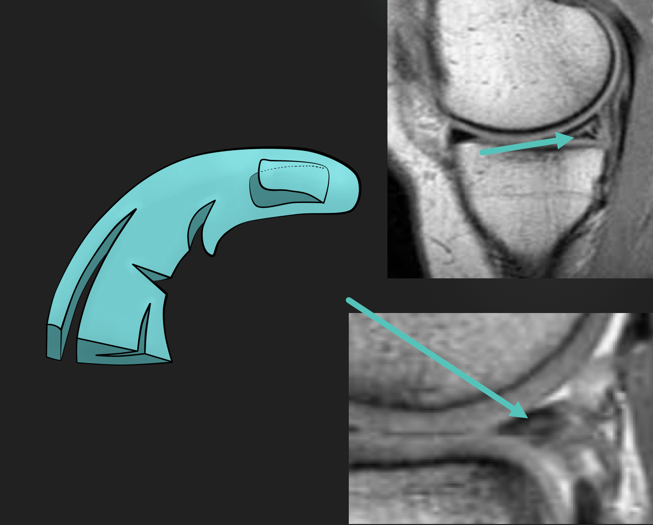 RTG nebo MRI ukázka z diagnostického kurzu