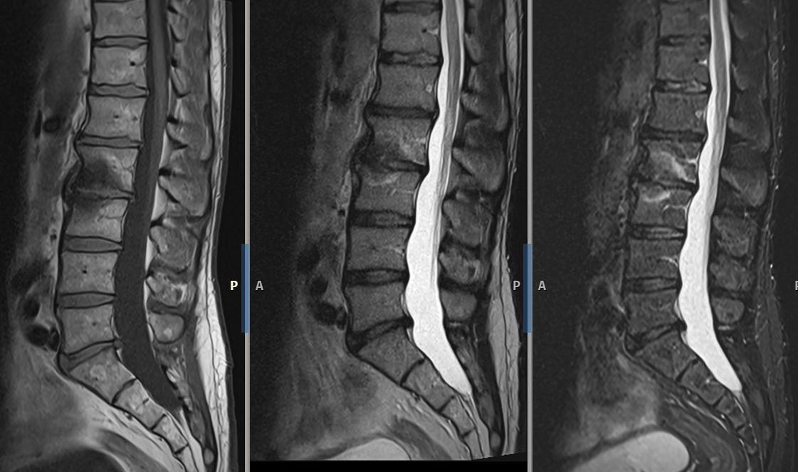 RTG nebo MRI ukázka z diagnostického kurzu